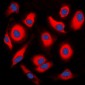 Anti-APOA1BP Antibody